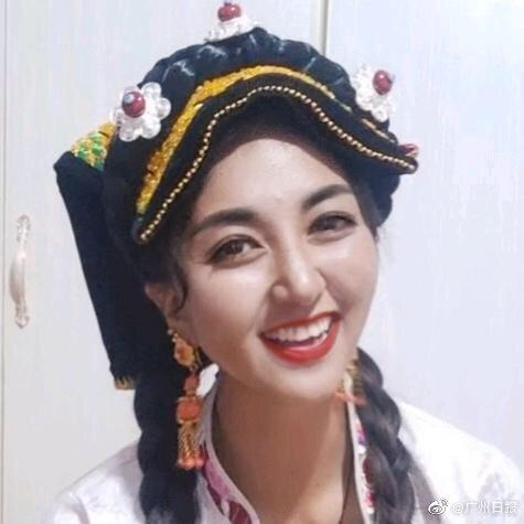 美女网红拉姆直播时 被前夫用汽油烧得面目全非