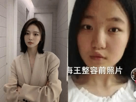 海王项思醒旧照曝光，整容前后判若两人