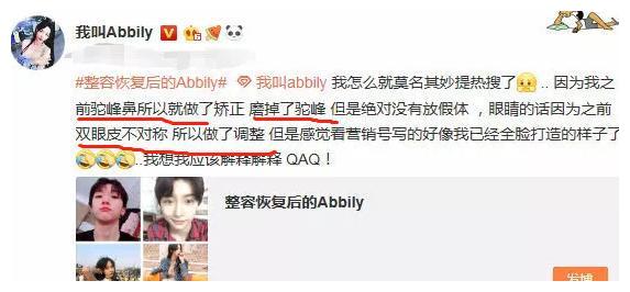 网红艾比近照曝光，瓜子V脸变肉腮，被称越整越像尬舞韩星潘南奎